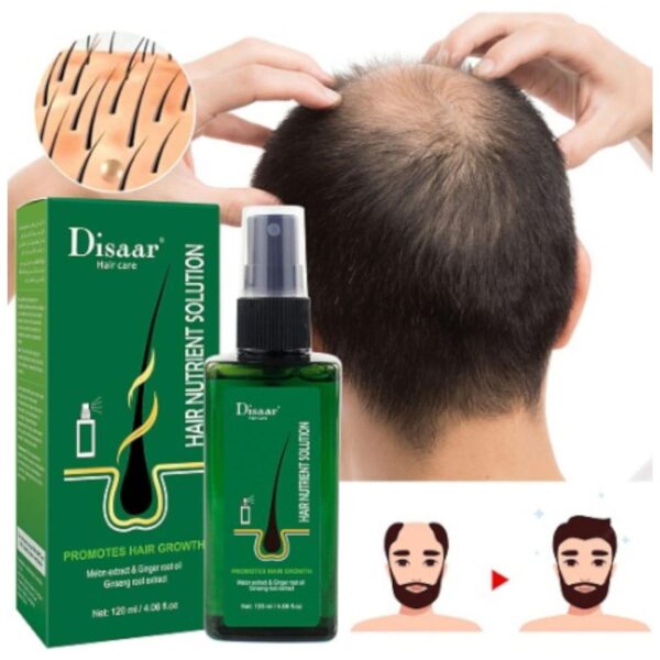 Natural Hair Growth Essence - Image 2