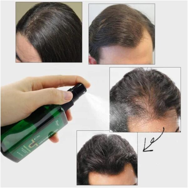 Natural Hair Growth Essence - Image 5