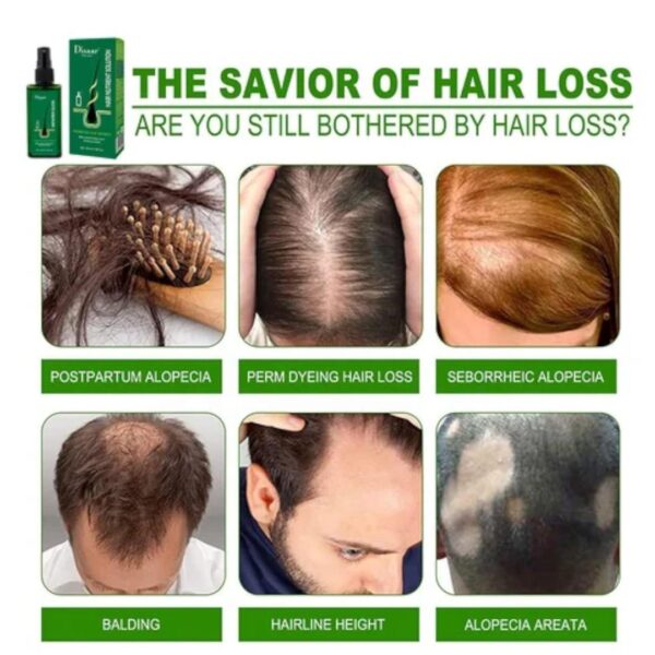 Natural Hair Growth Essence - Image 6